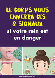 Epingle Sur Sante
