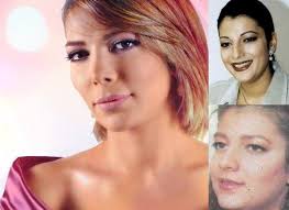 أصالة نصري خضعت للعديد من عمليات التجميل. Fay3 ØµÙˆØ± ÙÙ†Ø§Ù†Ø§Øª Ø¹Ø±Ø¨ÙŠØ§Øª Ù‚Ø¨Ù„ ÙˆØ¨Ø¹Ø¯ Ø®Ø¶ÙˆØ¹Ù‡Ù† Ù„Ø¹Ù…Ù„ÙŠØ§Øª ØªØ¬Ù…ÙŠÙ„ Ø§Ù„Ø£Ù†Ù Ø£ØµØ§Ù„Ù‡ Ù†ØµØ±ÙŠ Ù…Ø´Ø§Ù‡ÙŠØ±