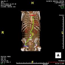 BACKGROUND DISCUSSION RESULTS METHODS REFERENCES CONCLUSIONS