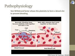 Von Willebrand Disease Ppt Download