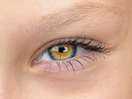 The dominant color of the iris tends to be low in melanin, so the outer hue will almost always be a shade or blue or green. Gorgeous Central Heterochromia Eyes Heterochromia Eyes Beautiful Eyes Color Central Heterochromia Eyes