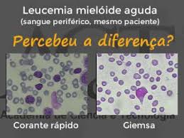 O primeiro corante foi arrastado pelo álcool, sendo posteriormente recoradas pelo segundo corante. Corante Bom Vs Corante Ruim Youtube