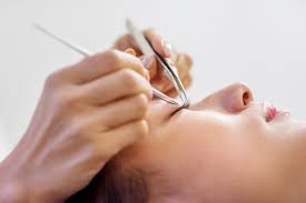 top 20 orte fur laser haarentfernung in berlin treatwell