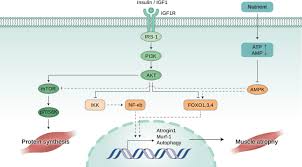 Image result for Cachexia in Cancer