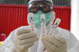Hasil Rapid Test Reaktif Covid 19 Pemuda Di Aceh Kabur Dan Belum Ditemukan
