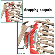 It sticks out like a trowel handle that you can tap along the surface. Snapping Scapula Syndrome Orthopedic Surgeon Richmond Va