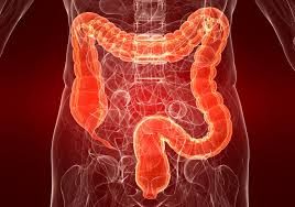 Circa 6 anni fa durante un'ecografia addominale mi hanno diagnosticato la presenza di due polipi alla colecisti il maggiore di 5mm. Che Cosa Sono E Come Si Rimuovono I Polipi Intestinali Fondazione Umberto Veronesi