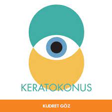 Ailede Bir Keratokonus Hastasi Varsa Ozellikle Dikkat Edilmelidir Cunku Keratokonusta Genetik Faktor Onemli Rol Oynamaktadir Kudretgoz Goz Hastane Saglik
