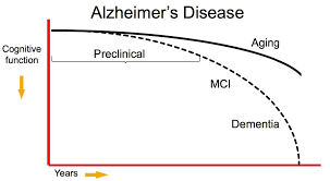 Image result for alzheimer's disease