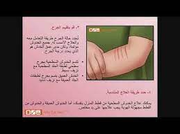 بيتس جوت ويب تقدم لكم كيفية التعامل مع خدوش القطط petsgotweb pandora screenshot