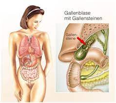 Hausmittel Gegen Gallenbeschwerden Verwendung Nutzen Fur Gesundheit Gesundpedia De