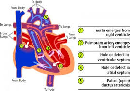 There are 217 arteries diagram for sale on etsy, and they cost 12,80 $ on average. Diagram Of Transposition Of The Great Arteries Image Eurekalert Science News