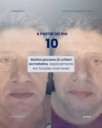 Dr Geronimo Silva l Blefaroplastias l Tricologia (@drgeronimosilva) •  Instagram photos and videos