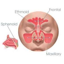 Image result for Sinus Surgery