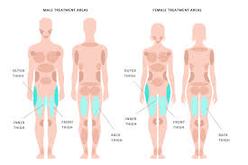 B rotate your torso to the right as you press the dumbbell in your left hand at a slight angle above your shoulder. Hips Thighs Kleinlipo Liposuction Surgery Of Orange County