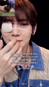 Yeosang Que Acoteceu Olhos