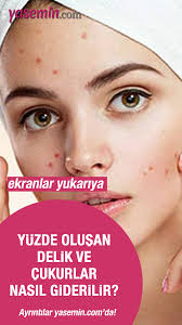 Yuzde Olusan Delik Ve Cukurlar Nasil Gecer Yuzde Delik Neden Olur Yuzler Sivilce Izi Genetik