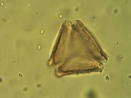 Image result for Tessmannia burttii