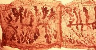 This Micrograph Reveals The Organ Morphology Within Taenia Solium Tapeworm Proglottids The Proglottids Of Taenia Species Can Be Identified By The Number Of Ute