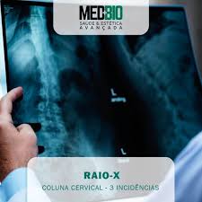 RX - Coluna cervical - 3 incidências