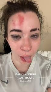 Praise report My daughter, 8, is a hunter jumper, horse riding. She had a  bad fall yesterday and we were worried she fractured a vertebrae because of  her back pain. Thank God