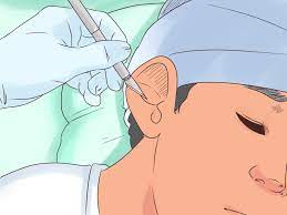 How to get fluid out of ear. 3 Ways To Remove Fluid In Ears Wikihow