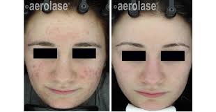 Bluestone Natural Medicine