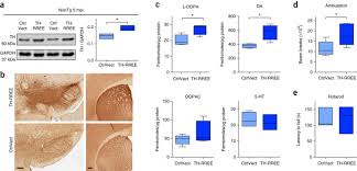Seleccionar / select español/ingles español/portugues. Dopamine Induces Soluble A Synuclein Oligomers And Nigrostriatal Degeneration Nature Neuroscience