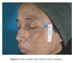 A double-blind study…