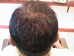 If you are looking for a hair system that will. Natural And Undetectable Hair Wigs For Men Scalp Effect And Skin Showing Naturalhairwigs Hairwigs Undet Hair Wigs For Men Advanced Hair Hair Care Solutions