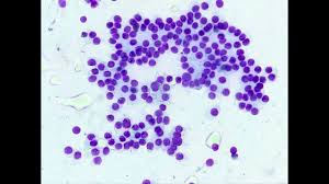 Image result for Chemodectoma