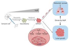 Find out more about malignant soft tissue tumors at cleveland clinic. Jci Hur Elavl1 Drives Malignant Peripheral Nerve Sheath Tumor Growth And Metastasis
