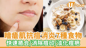 暗瘡肌抗痘消炎7種食物快速癒合／消除痘印／淡化痘疤| U Food