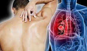 Pain can be brought about by several different causes. Lung Cancer Symptoms Signs Of A Tumour Include Lower Back Pain When To See A Doctor Express Co Uk