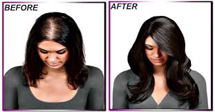 15 Effective Hair Masks To Treat Hair Loss Hair Treatment Mask Effective Hair Masks Hair Loss Remedies Women