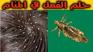 تفسير القمل للمتزوجة في المنام موقع خبر مباشر