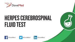 Coronary angiography cost in mumbai. Herpes Blood Test