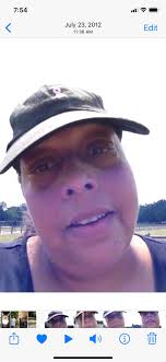 I've got my weight below 175 pounds wooohooo. I see my pulmonologist next  week . He will partition Mayo Clinic