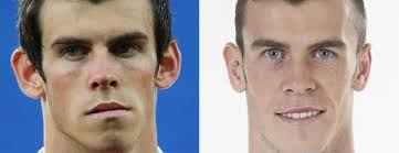 Как живет роналду в 2019? Delal Li Ronaldo Plasticheskuyu Operaciyu Plasticheskie Operacii Ronaldu I Messi