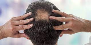 Reduces hair loss and promotes thick, beautiful hair. Worried About Losing Your Hair Here S How Massage Can Help
