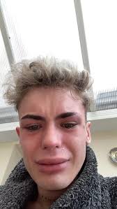 My £3k Turkey teeth made me look like a shark