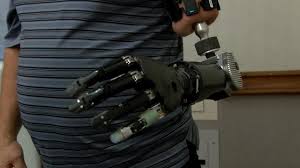 Just one of the more sophisticated devices he owns cost more than. Pioneer Of World S Most Advanced Prosthetic Arm Has Tucson Ties
