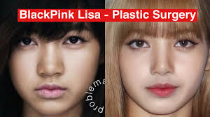 If you have already had lisa blackpink before plastic surgery and want 2. Blackpink Lisa S Plastic Surgery Youtube