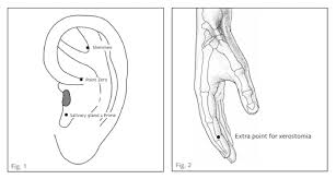 Contexte seulement il faut bien comprendre qu'on se situe ici dans un système de dépendance. Secheresse Buccale Et Acupuncture Dr Nguyen Acupuncteur A Paris