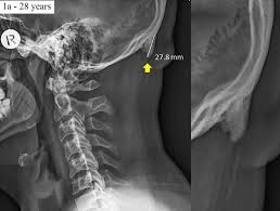 Learn human bones for anatomy class by using these easy memory tricks (mnemonics)! About The Idea That You Re Growing Horns From Looking Down At Your Phone The New York Times