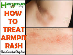 Red Rash Under Armpit Can Be Itchy Irritating And Sometimes Very Painful Constant Sweat Friction Bacterial Or Fungal Infe Armpit Rash Underarm Rash Armpits
