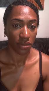 Remote Dermatology Career Opportunities