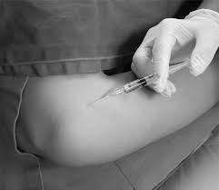 Image result for Biceps Tendon Injection