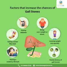 Factors That Increase The Chances Of Gall Stones In 2020 Gallstones Gallbladder Fiber Diet