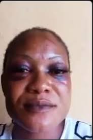 Freed Victim Narrates how Rivers Kidnappers Killed 3 Women and Sold their  Body Parts